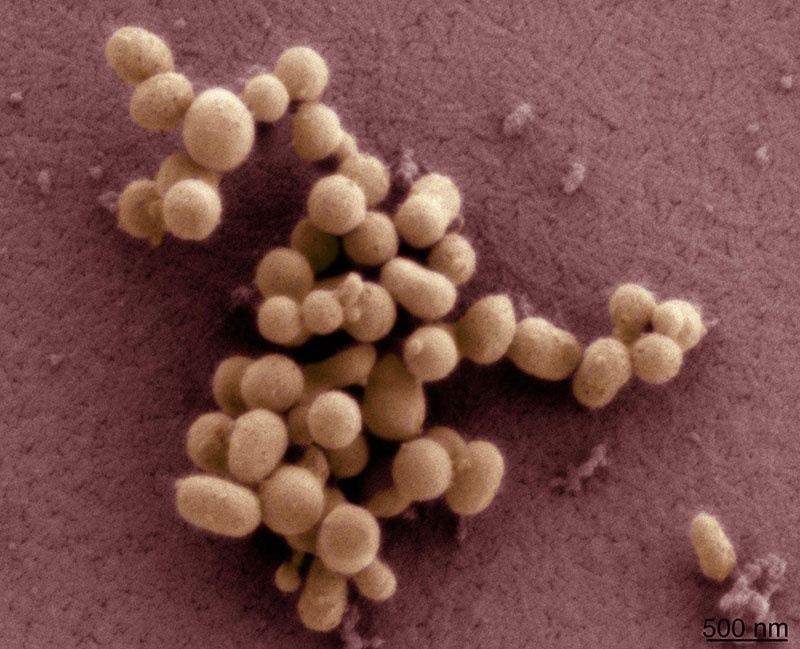 Бактерия искусственного происхождения Mycoplasma laboratorium под названием «Синтия».