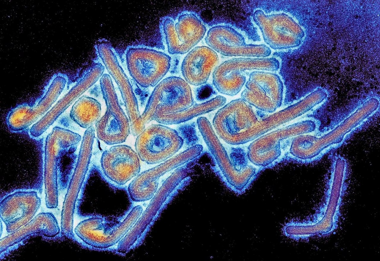 Микрофотография вируса Марбурга.