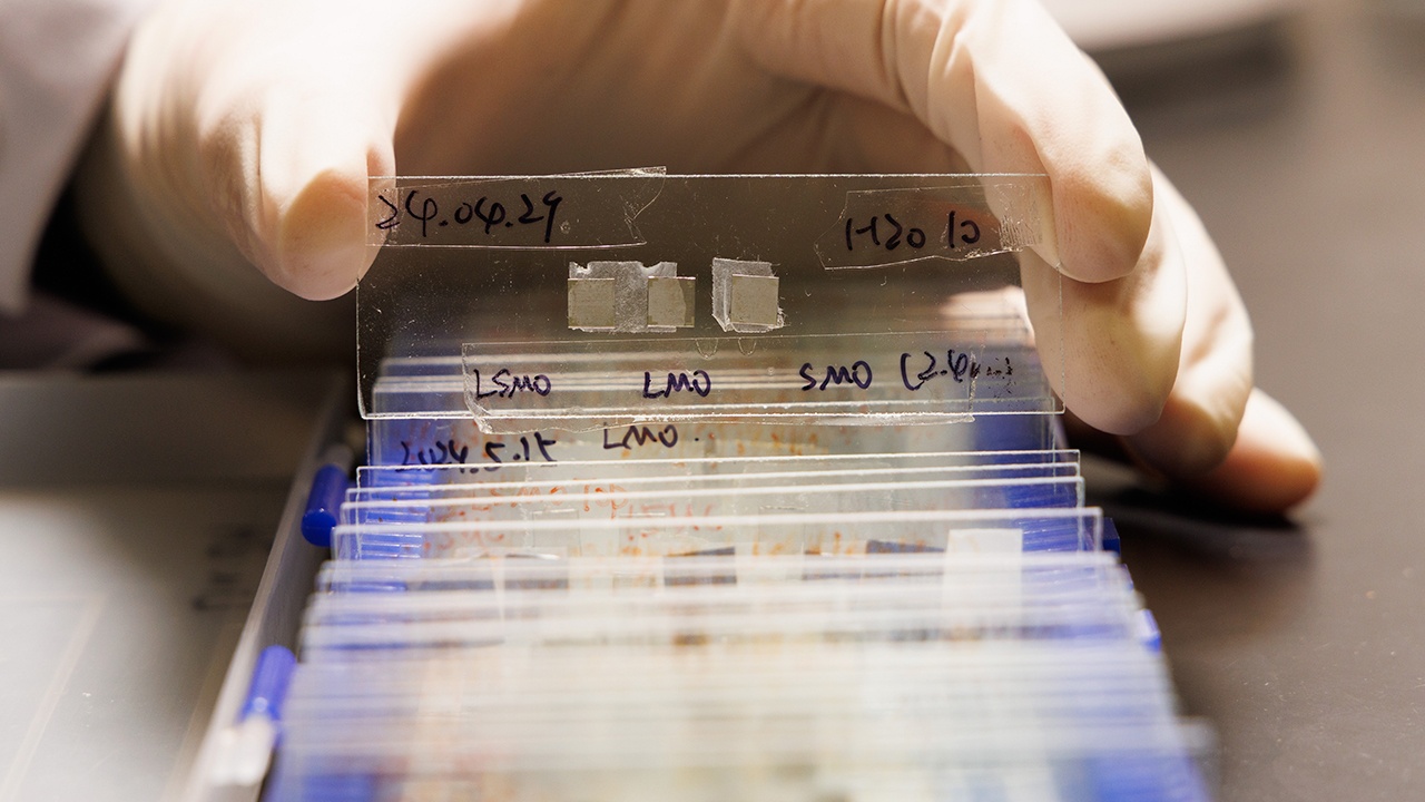 Число заболевших обезьяньей оспой в Подмосковье выросло до трех