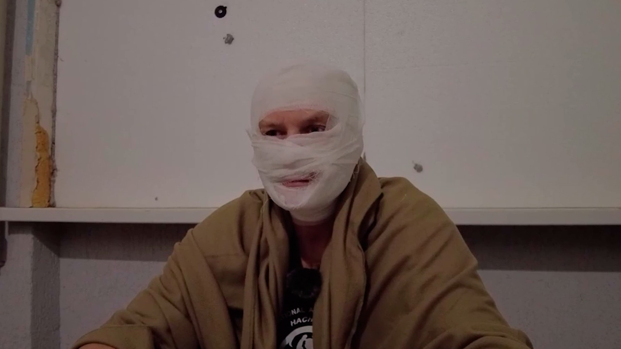 Пленный: у боевиков под Купянском-Узловым обморожены руки и ноги