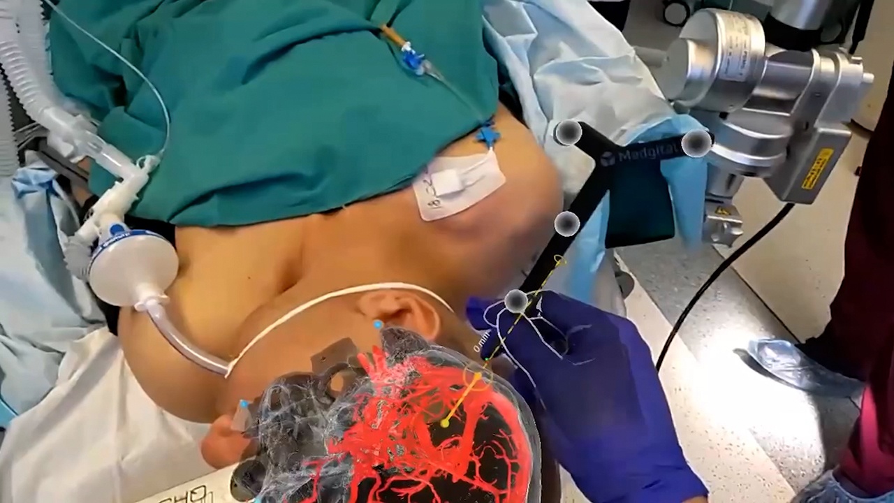 Хирургия будущего: врачи госпиталя Бурденко провели операцию при помощи АР-очков